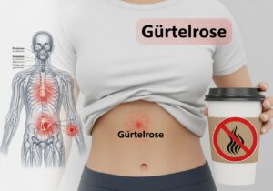 Warum kein Kaffee bei Gürtelrose?